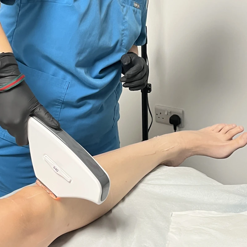 Laser Hair Removal Maryport